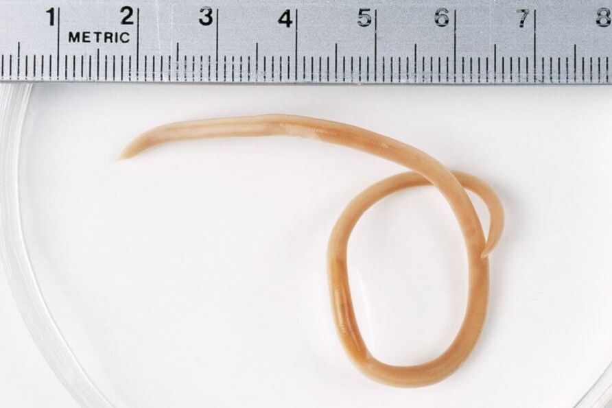 Ascaris е кръгъл червей, живеещ в човешкото тяло