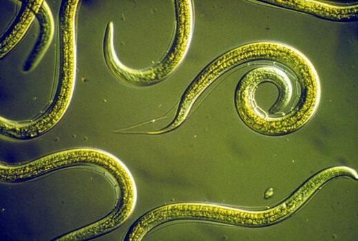 Паразитни червеи нематоди в тънките черва на човека