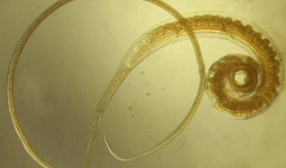 Трихоцефалез whipworm